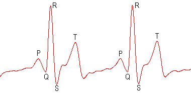 ../../../../_images/ecg_peak_names.gif